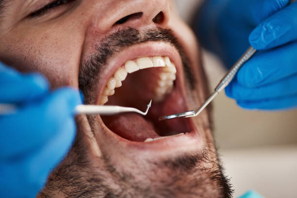 Best Emergency Root Canal Therapy in Burlington, ND